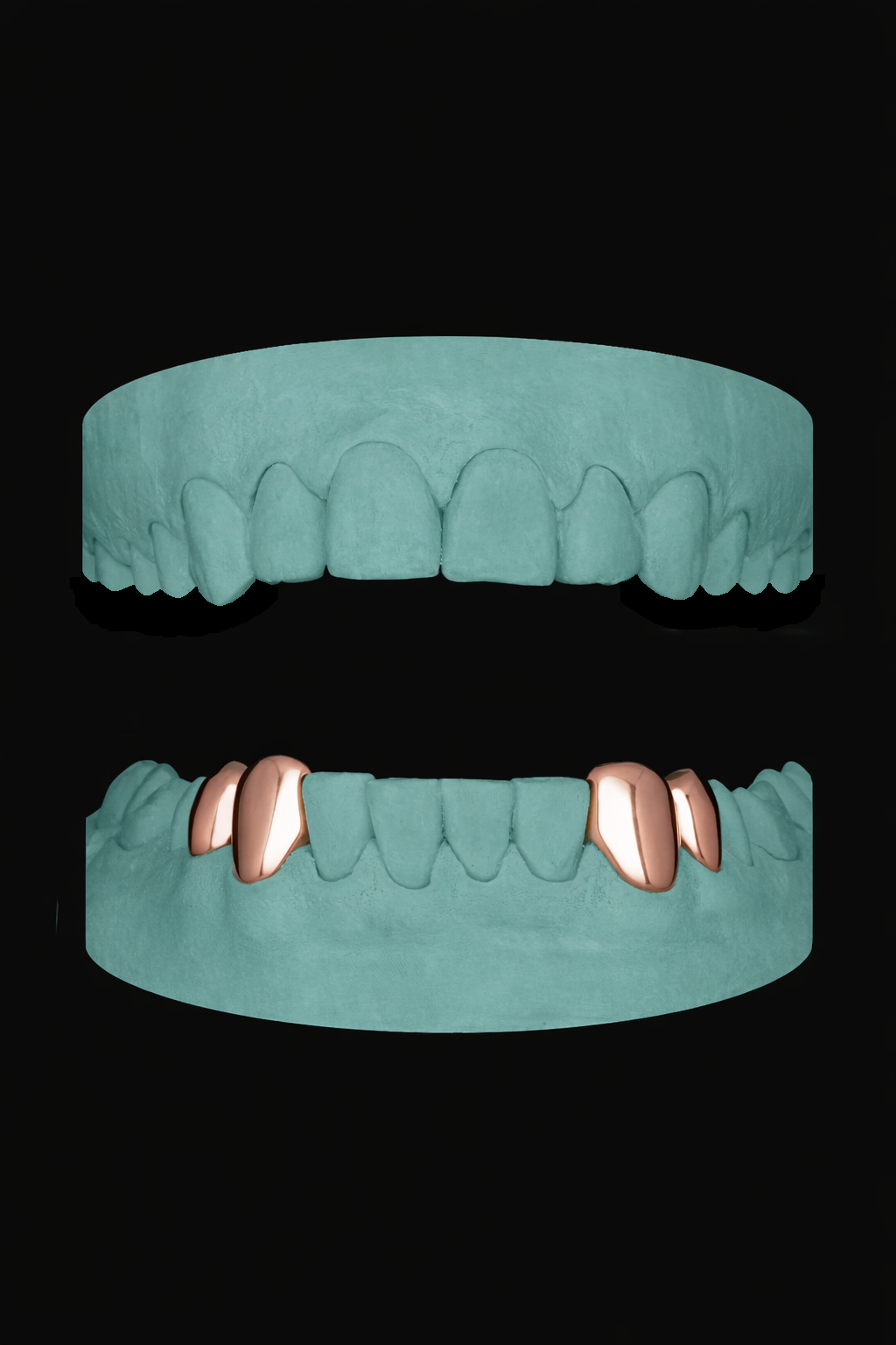 4 Teeth Grillz