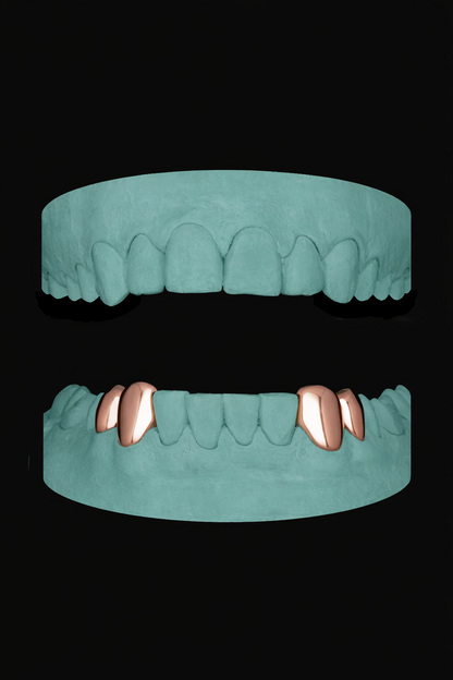 4 Teeth Grillz