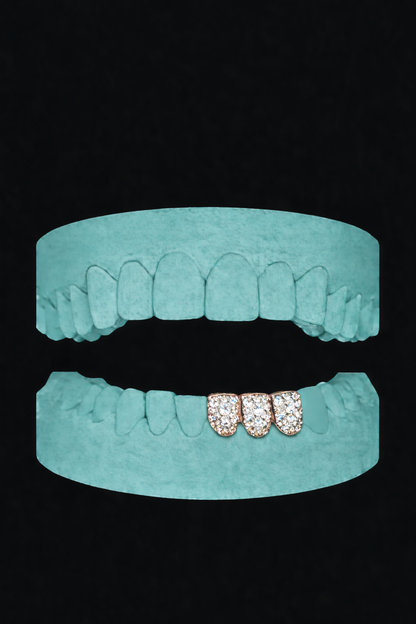 3 Teeth Grillz