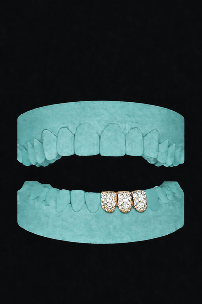 3 Teeth Grillz