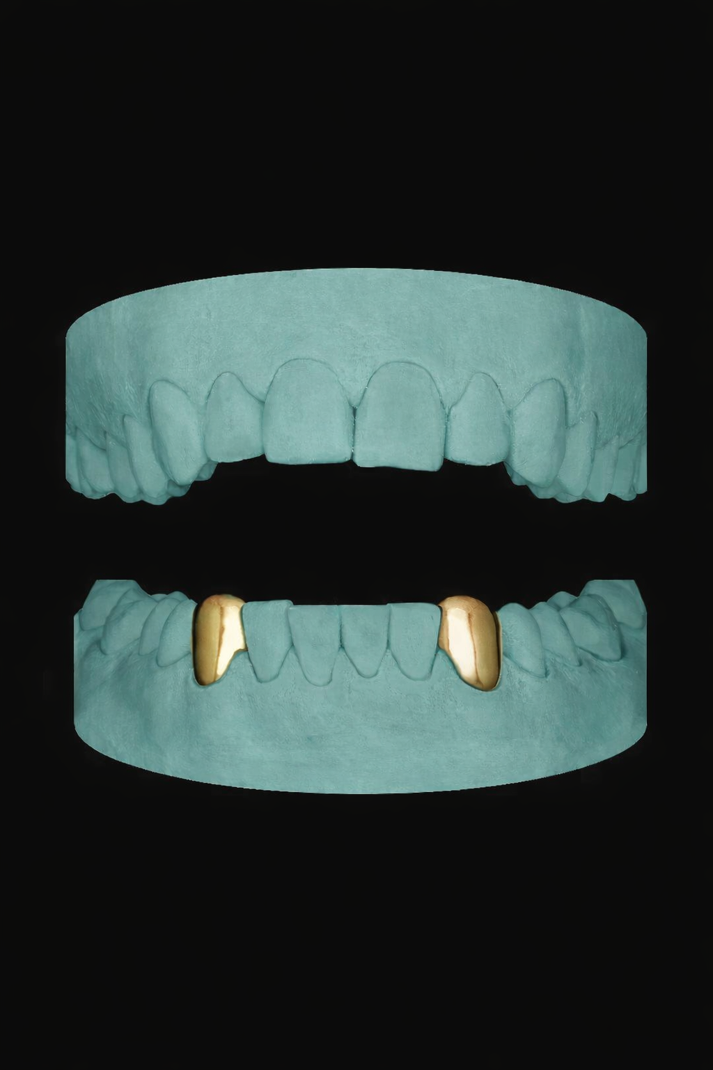 2 Teeth Grillz