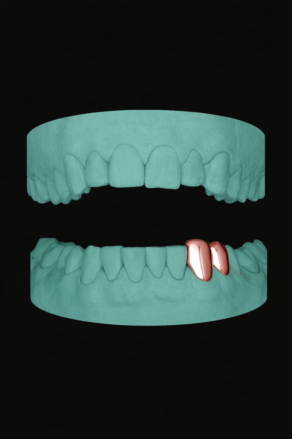 2 Teeth Grillz