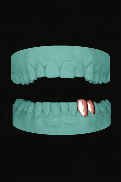 2 Teeth Grillz