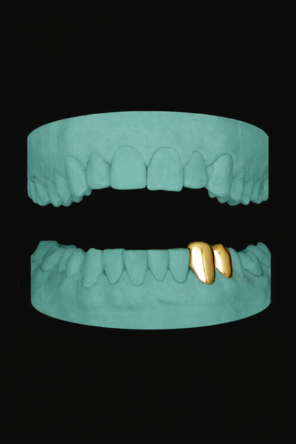 2 Teeth Grillz