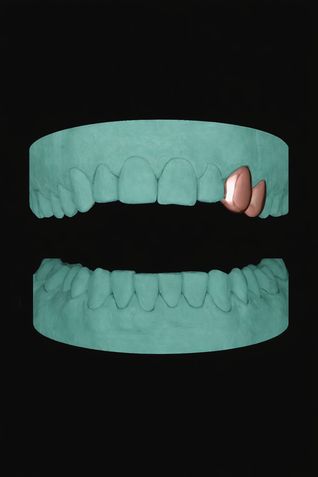 2 Teeth Grillz