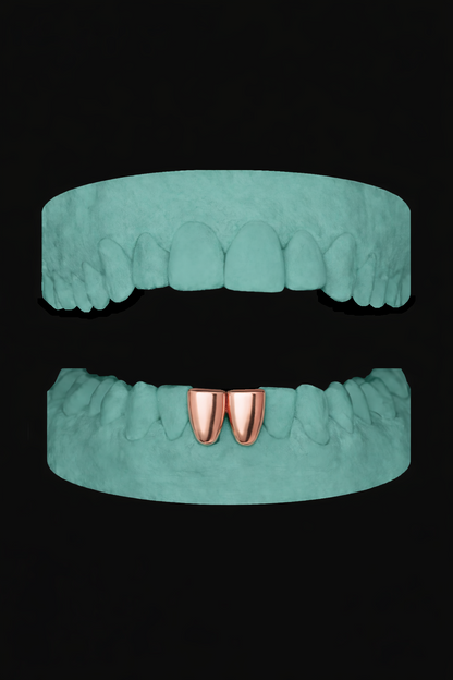2 Teeth Grillz