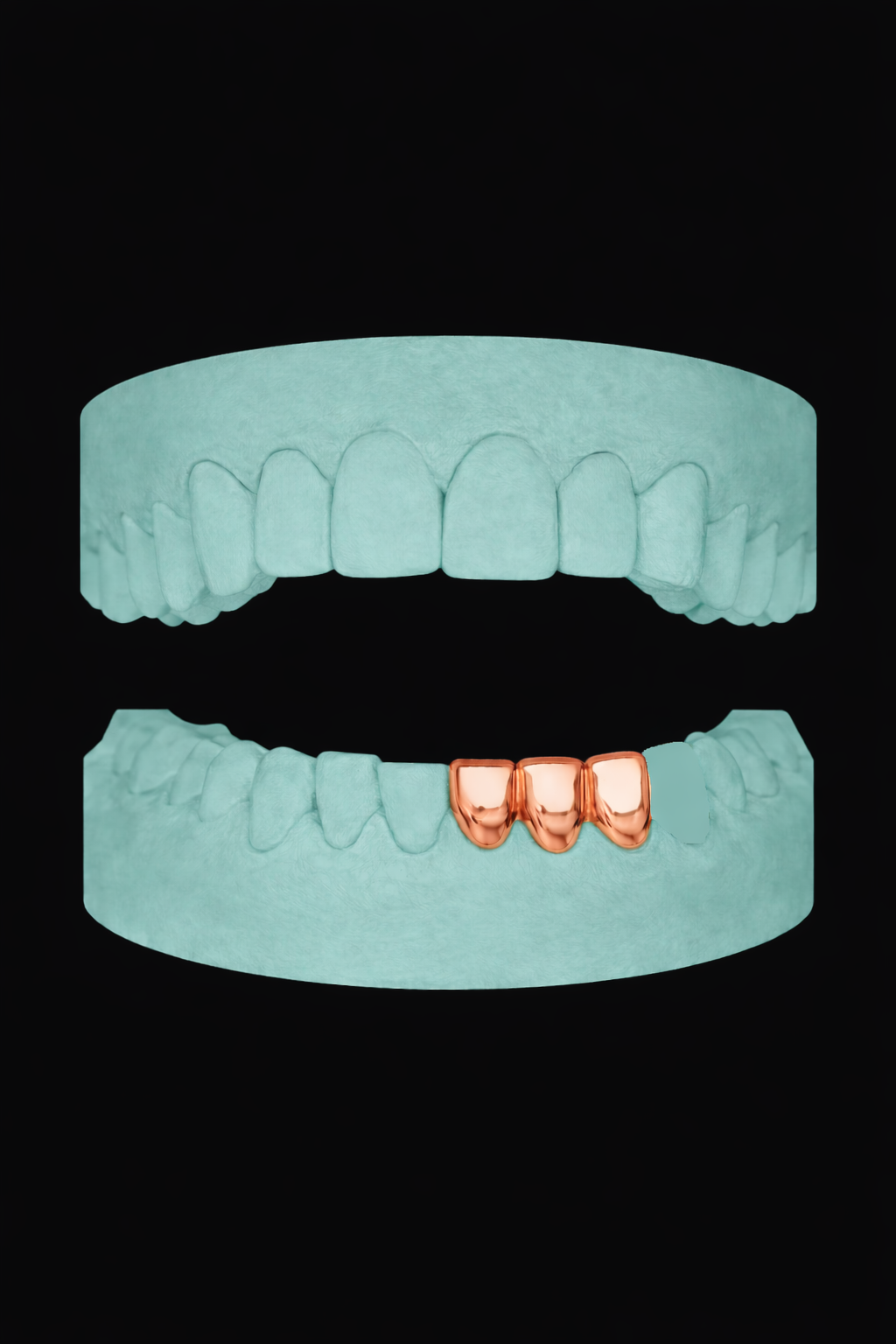 3 Teeth Grillz