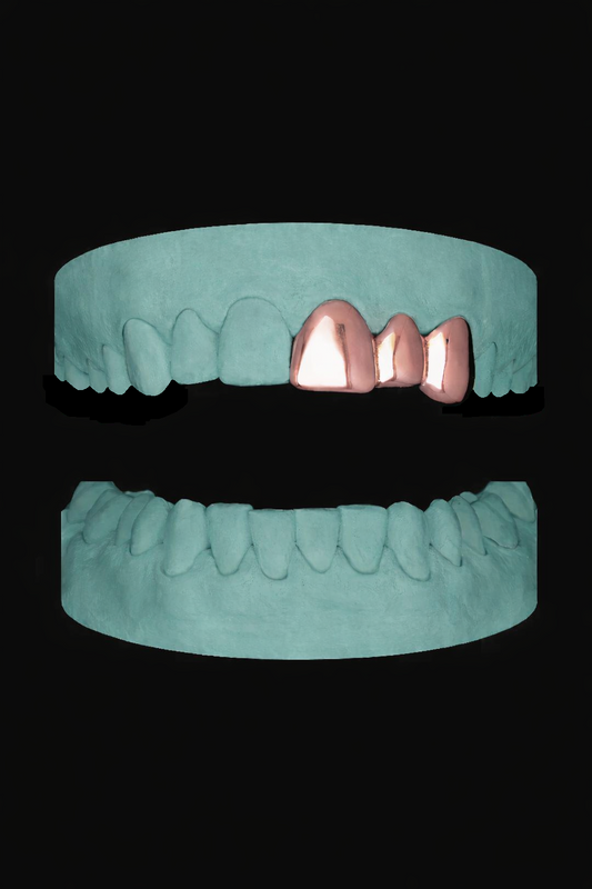 3 Teeth Grillz