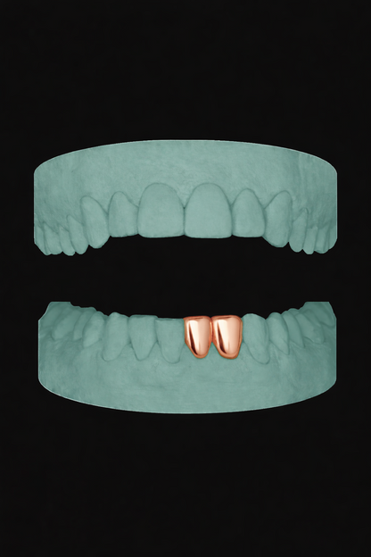 2 Teeth Grillz