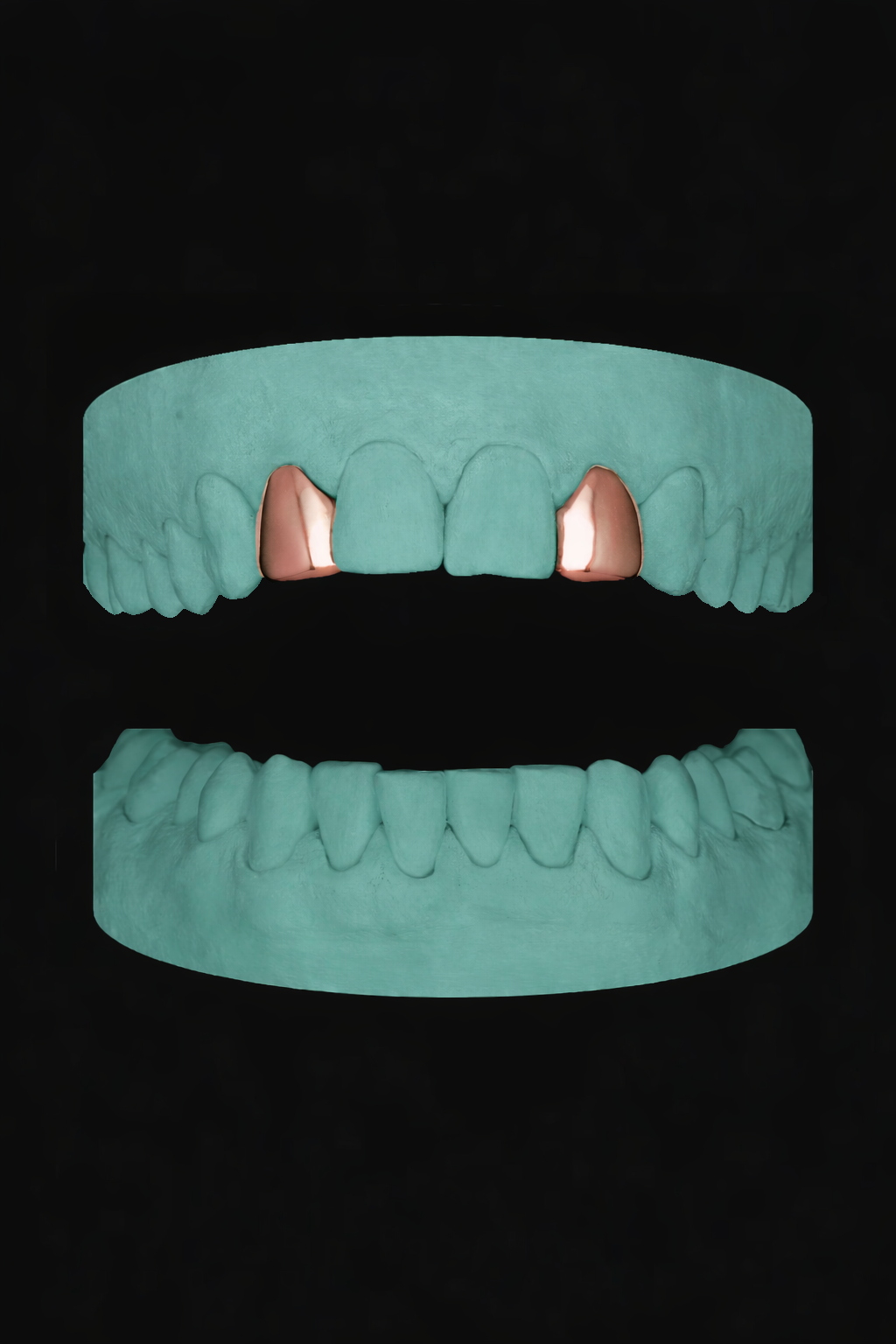 2 Teeth Grillz