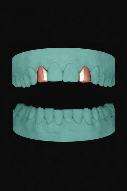 2 Teeth Grillz