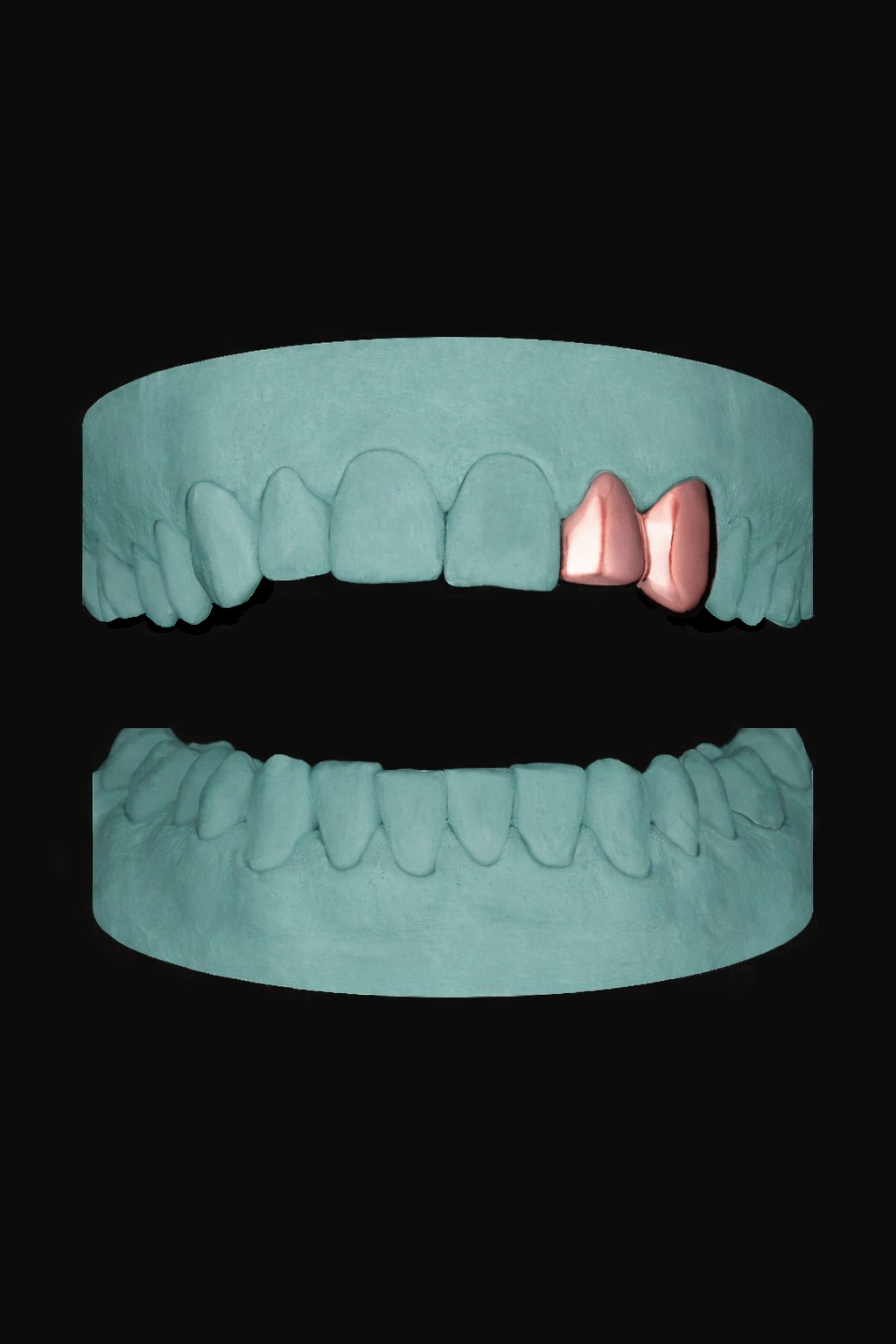 2 Teeth Grillz