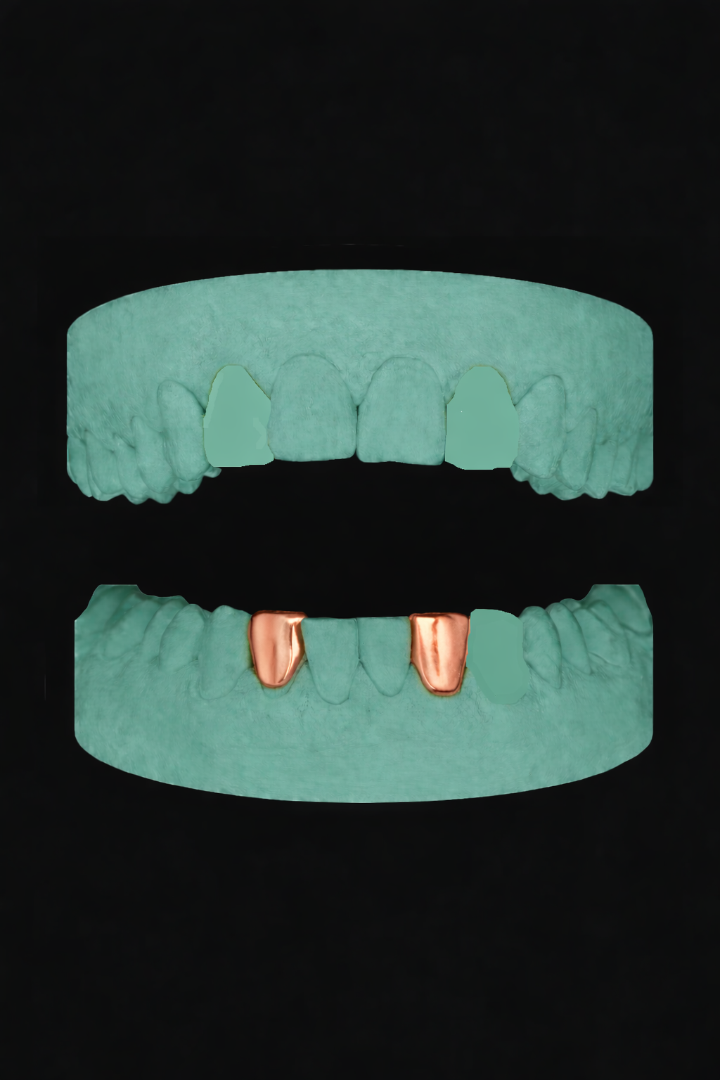 2 Teeth Grillz