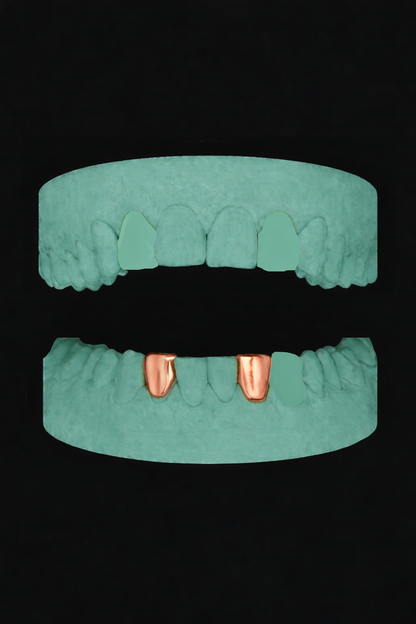 2 Teeth Grillz