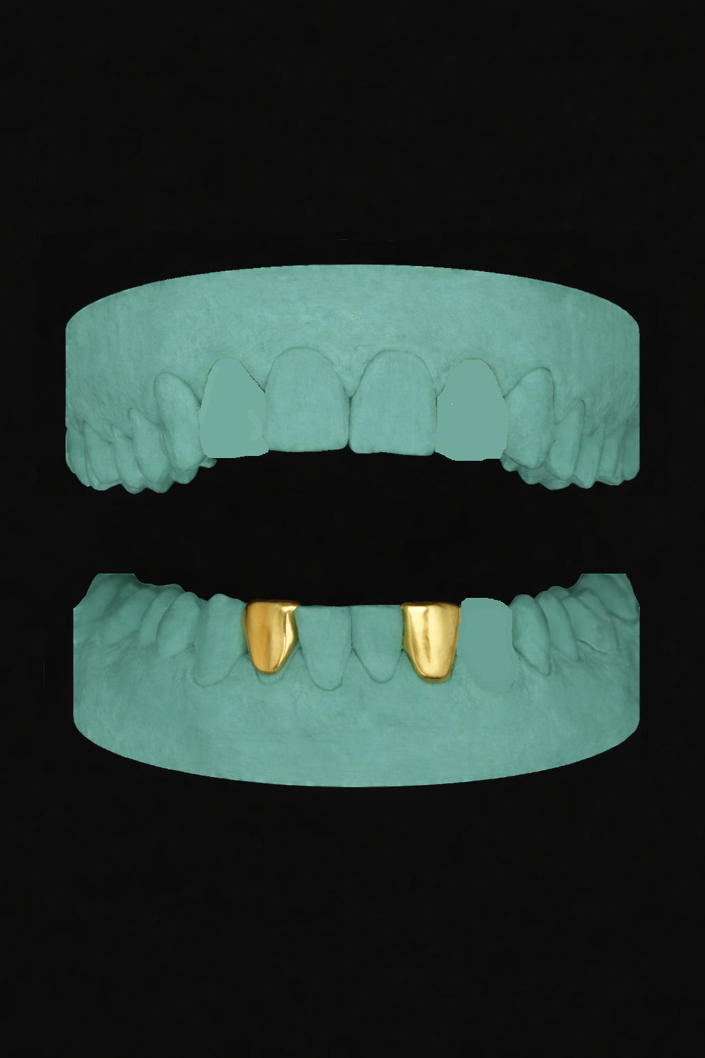 2 Teeth Grillz
