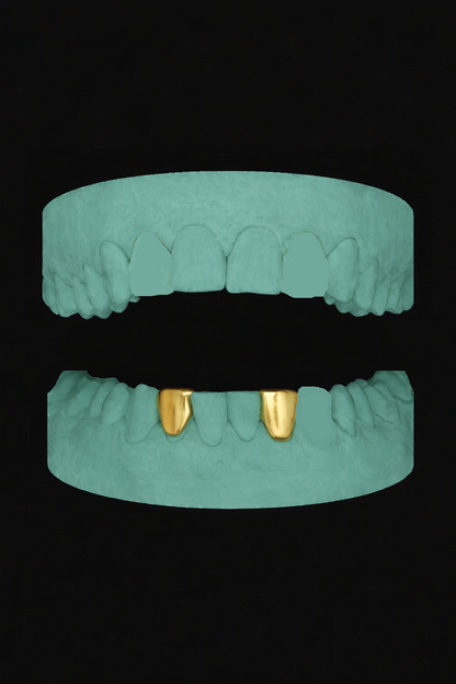 2 Teeth Grillz